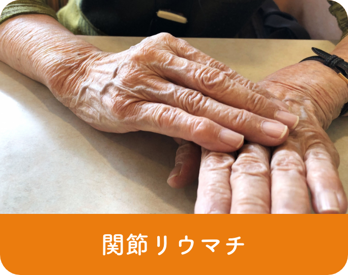 関節リウマチ